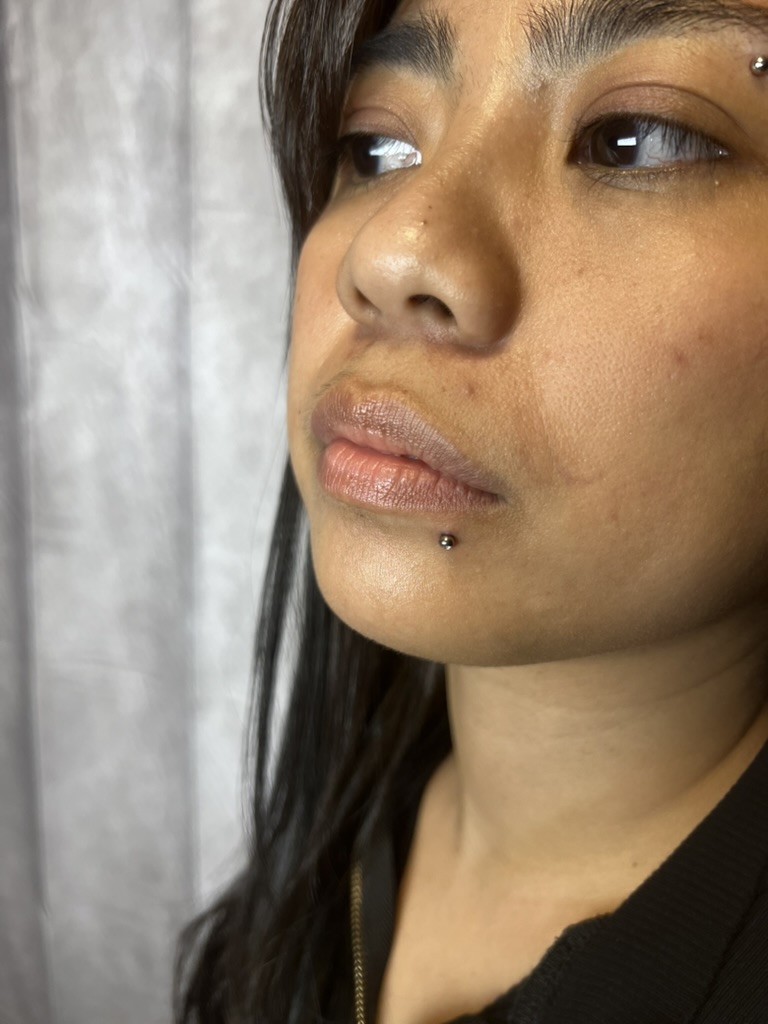 Swelling example — Facial piercing — Work of Art Las Vegas, Work of Art Tattoo & Piercing, Las Vegas